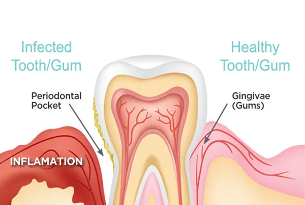 Ramayana Dental