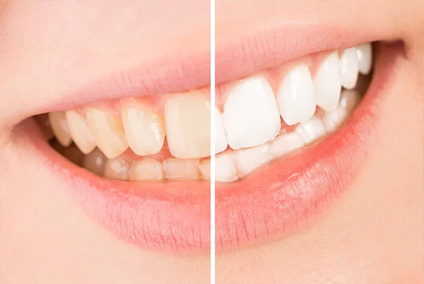 Ramayana Dental