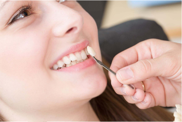 Teeth Whitening