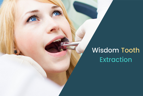 Wisdom Tooth Removal