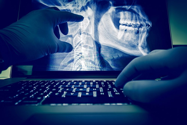 Digital X-Ray